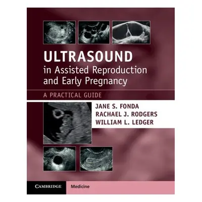 Ultrasound in Assisted Reproduction and Early Pregnancy - Fonda, Jane S. (University of Sydney) 