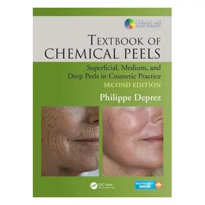 Textbook of Chemical Peels - Deprez, Philippe (Clinical Hera, Empuriabrava, Spain)