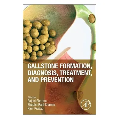 Gallstone Formation, Diagnosis, Treatment and Prevention