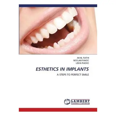 Esthetics in Implants - Rathi, Akhil a Pande, Neelam a Radke, Usha