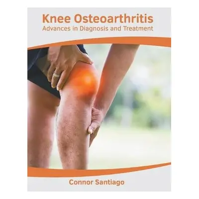 Knee Osteoarthritis: Advances in Diagnosis and Treatment