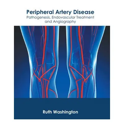 Peripheral Artery Disease: Pathogenesis, Endovascular Treatment and Angiography