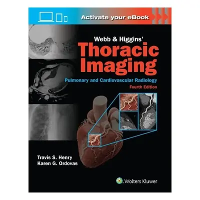 Webb a Higgins Thoracic Imaging: Print + eBook with Multimedia - Henry, Travis a ORDOVAS, KAREN 