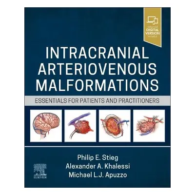 Intracranial Arteriovenous Malformations