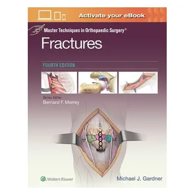 Master Techniques in Orthopaedic Surgery: Fractures - Gardner, Michael J.