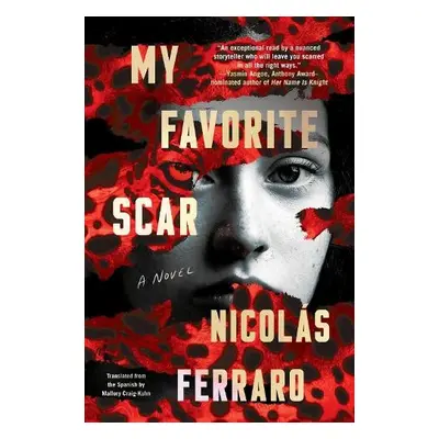 My Favorite Scar - Ferraro, Nicolas a Craig-Kuhn, Mallory