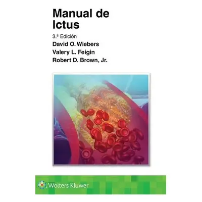 Manual de ictus - Wiebers, David O. a Feigin, Valery L. a Brown, Jr., Robert D.