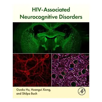 HIV-Associated Neurocognitive Disorders