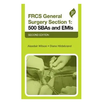 FRCS General Surgery Section 1: 500 SBAs and EMIs - Wilson, Alasdair a Hildebrand, Diane