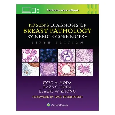 Rosen's Diagnosis of Breast Pathology by Needle Core Biopsy - Hoda, Syed A. a Hoda, Raza S. a Zh