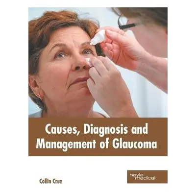 Causes, Diagnosis and Management of Glaucoma