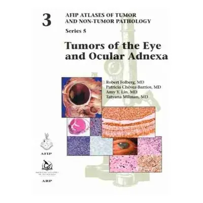 Tumors of the Eye and Ocular Adnexa - Folberg, Robert a Chevez-Barrios, Patricia a Lin, Amy Y. a