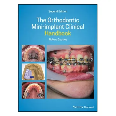 Orthodontic Mini-implant Clinical Handbook - Cousley, Richard (Consultant Orthodontist for the P