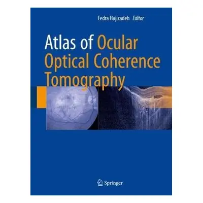 Atlas of Ocular Optical Coherence Tomography