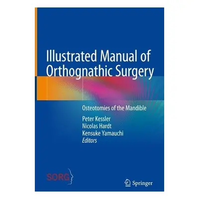 Illustrated Manual of Orthognathic Surgery