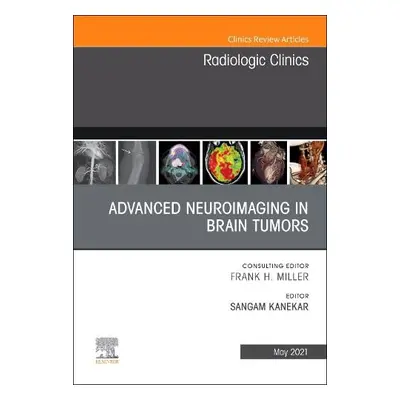 Advanced Neuroimaging in Brain Tumors, An Issue of Radiologic Clinics of North America