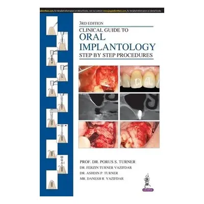 Clinical Guide to Oral Implantology - Turner, Porus S a Vazifdar, Ferzin Turner a Turner, Ashdin