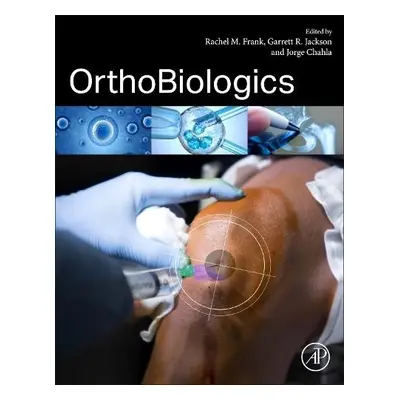 OrthoBiologics