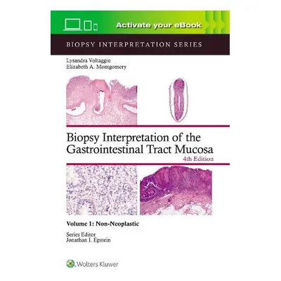 Biopsy Interpretation of the Gastrointestinal Tract Mucosa Volume 1 - VOLTAGGIO, LYSANDRA a MONT