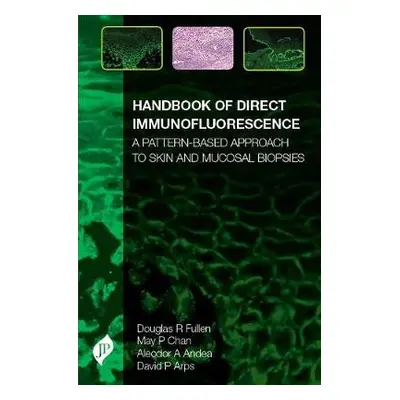 Handbook of Direct Immunofluorescence - Fullen, Douglas a Chan, May P a Andea, Aleodor A a Arps,