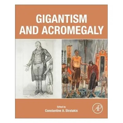 Gigantism and Acromegaly