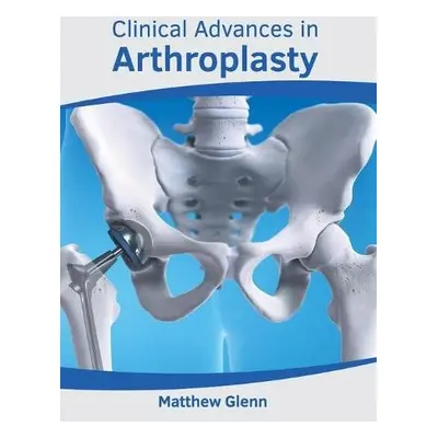 Clinical Advances in Arthroplasty