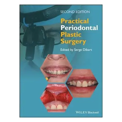 Practical Periodontal Plastic Surgery