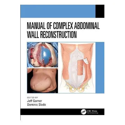 Manual of Complex Abdominal Wall Reconstruction