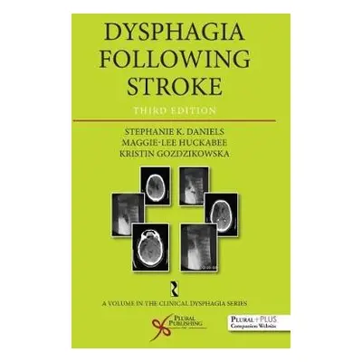 Dysphagia Following Stroke - Daniels, Stephanie K. a Huckabee, Maggie Lee a Gozdzikowska, Kristi