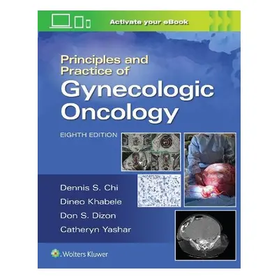 Principles and Practice of Gynecologic Oncology - CHI, DENNIS a Berchuck, Andrew a Dizon, Don S.