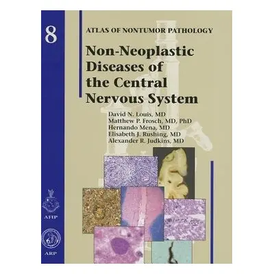 Non-Neoplastic Diseases of the Central Nervous System - Louis, David N. a Frosch, Matthew P. a M