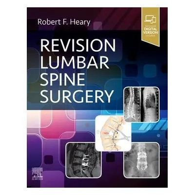 Revision Lumbar Spine Surgery