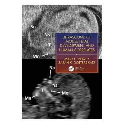 Ultrasound of Mouse Fetal Development and Human Correlates - Peavey, Mary C. a Dotters-Katz, Sar