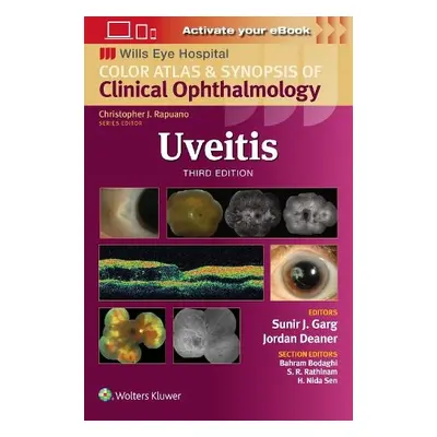 Uveitis - Garg, Sunir J.