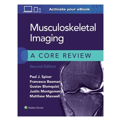 Musculoskeletal Imaging: A Core Review - Spicer, Paul a Beaman, Francesca a Blomquist, Gustav a 