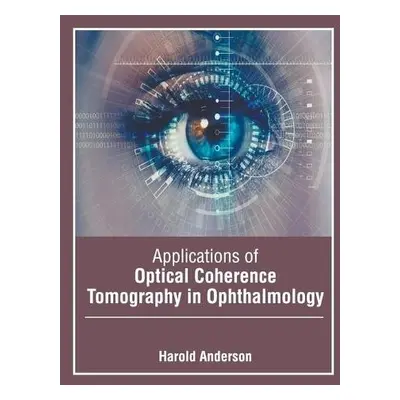 Applications of Optical Coherence Tomography in Ophthalmology