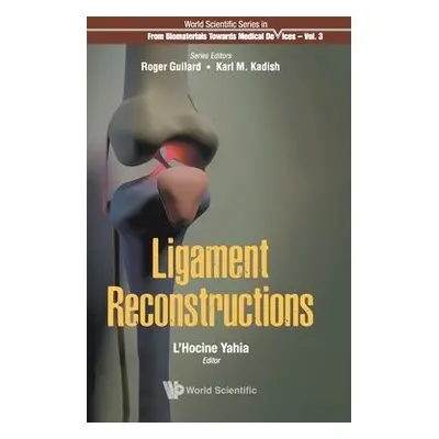 Ligament Reconstructions