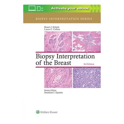 Biopsy Interpretation of the Breast - Schnitt, Stuart J. a Collins, Laura C.