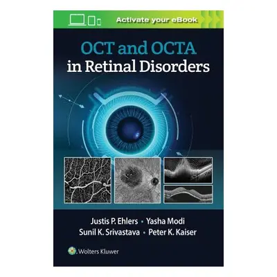 OCT and OCTA in Retinal Disorders - Ehlers, Justis P.