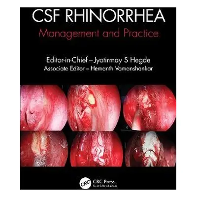 CSF Rhinorrhoea