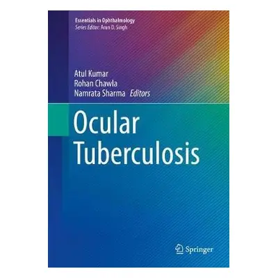 Ocular Tuberculosis