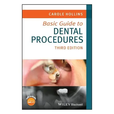 Basic Guide to Dental Procedures - Hollins, Carole (British Dental Association)