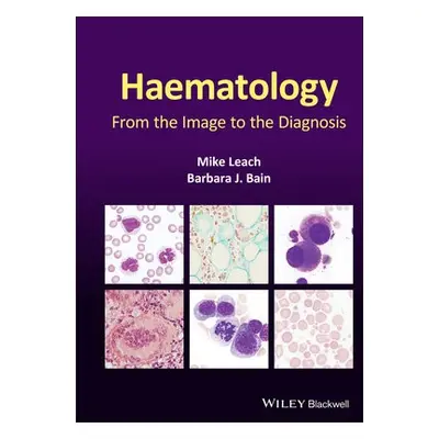 Haematology - Leach, Mike (Gartnavel General Hospital, Glasgow, UK) a Bain, Barbara J. (St Mary'