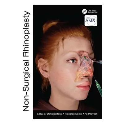 Non-Surgical Rhinoplasty