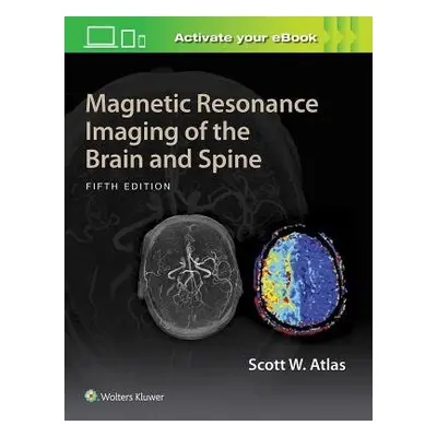 Magnetic Resonance Imaging of the Brain and Spine - Atlas, Scott W.