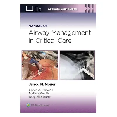 Manual of Airway Management in Critical Care: Print + eBook with Multimedia - Mosier, Jarrod, MD