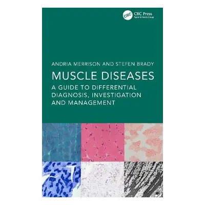 Muscle Diseases