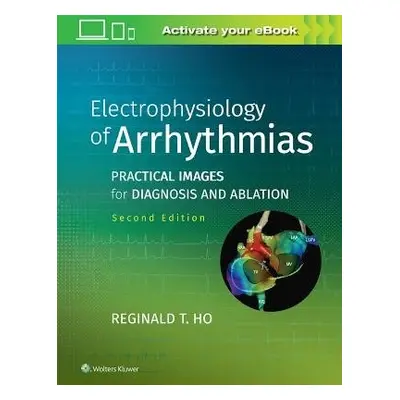 Electrophysiology of Arrhythmias - Ho, Reginald T.