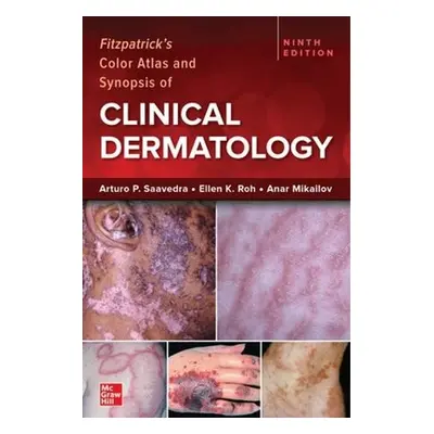 Fitzpatrick's Color Atlas and Synopsis of Clinical Dermatology, Ninth Edition - Saavedra, Arturo