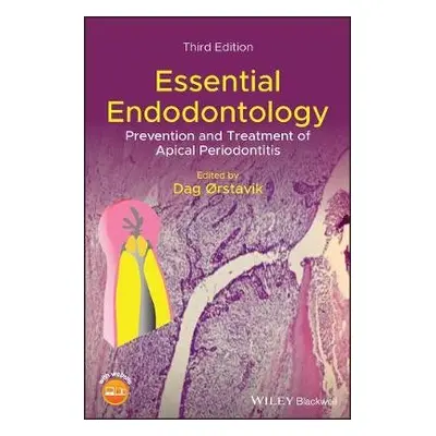 Essential Endodontology